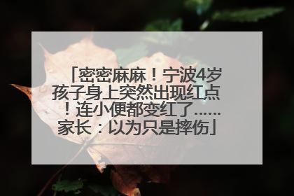 密密麻麻！宁波4岁孩子身上突然出现红点！连小便都变红了……家长：以为只是摔伤